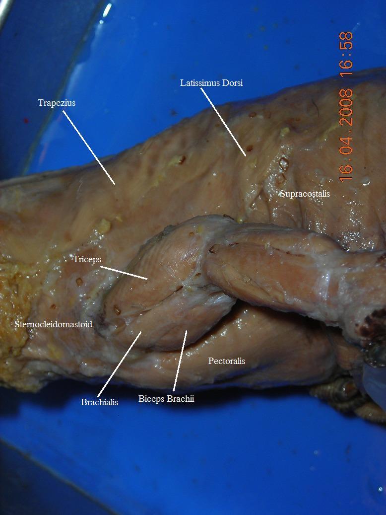 Forelimb