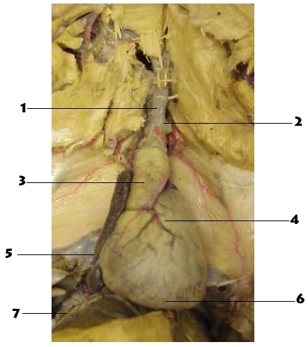 heart diagram labeled. Click for Labeled Diagram.